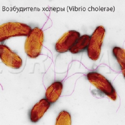 Холера