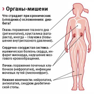 Диабетическая нефропатия