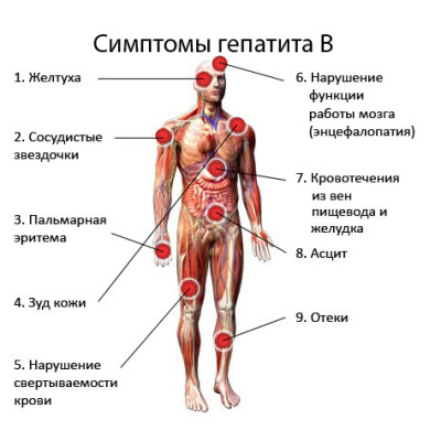 Гепатит В