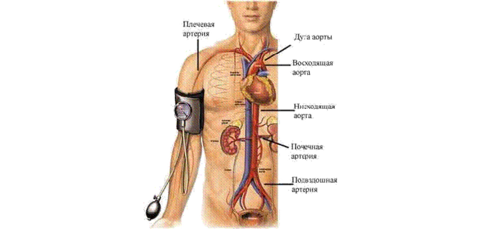 Малокровие (ишемия)