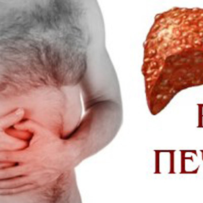 Рак печени