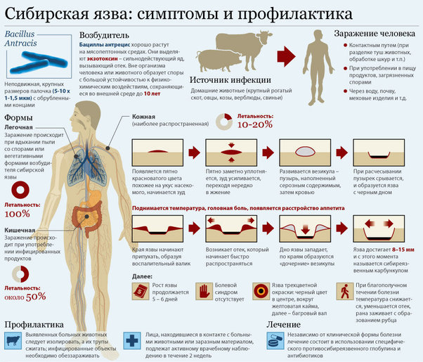 Сибирская язва