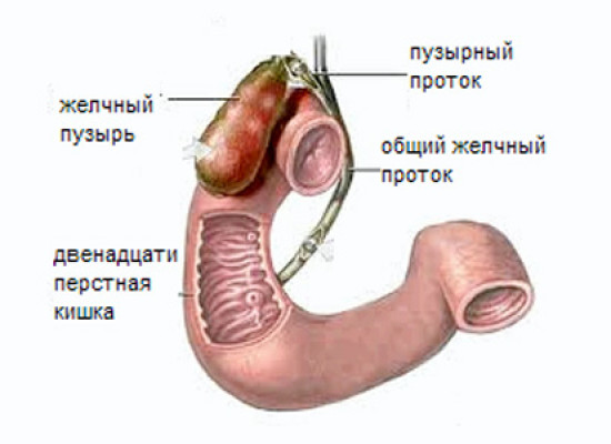 Желчные свищи