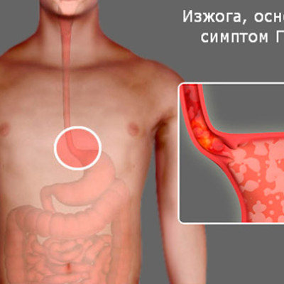 Болезни пищевода